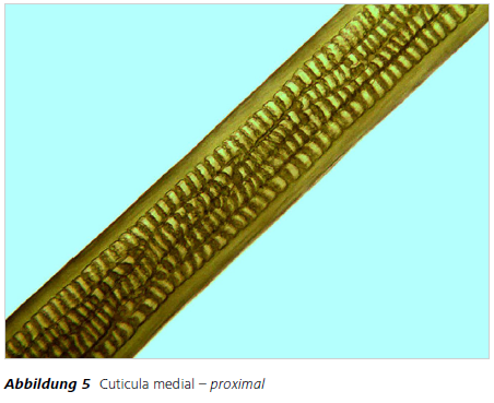 Abbildung 5 Cuticula medial – proximal